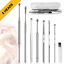 Ear Wax Removal Kit Cleaning Tool Earwax Pick Cleaner Curette Spoon Set Stainless